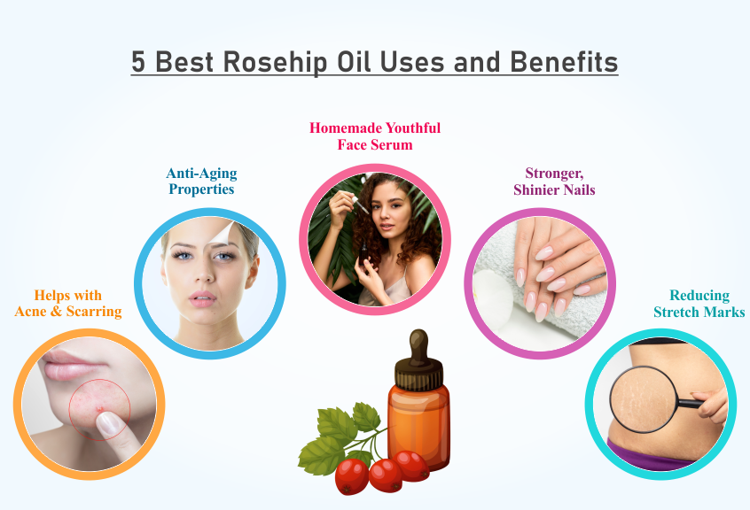 Rosehip Oil